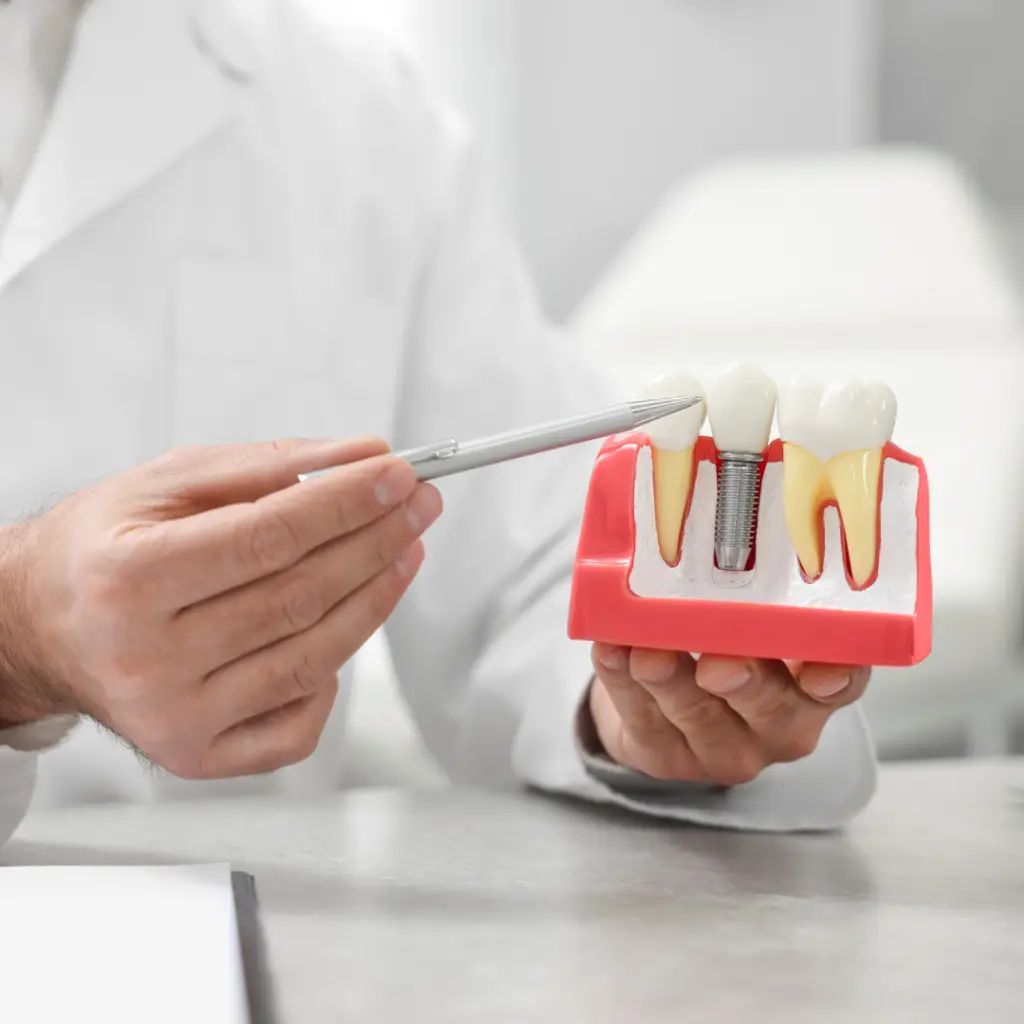 dental implants dubai